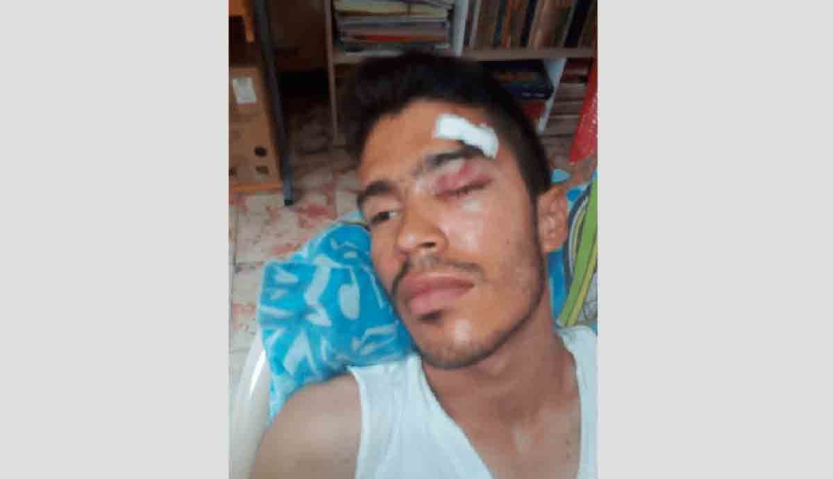 Delincuentes hieren a joven para robarlo en puente peatonal de Los Robles con Circunvalar