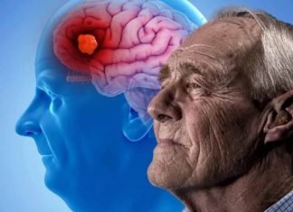 La enfermedad de Alzheimer es una forma de demencia progresiva, esto es lo primero que suele olvidar una persona con esta enfermedad